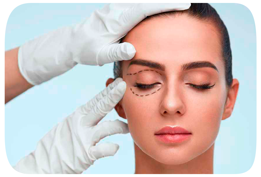 Blefaroplastia